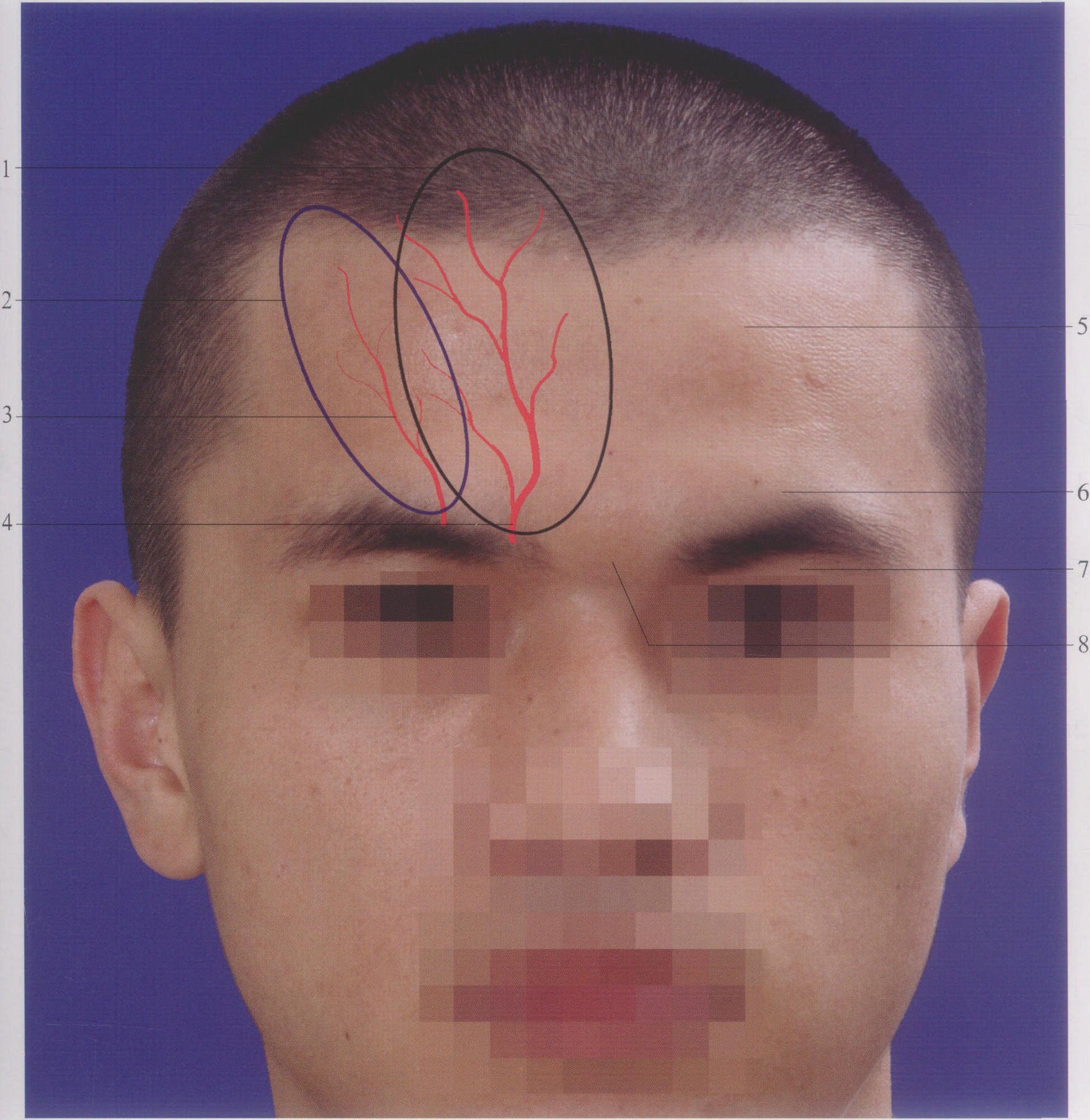 10. 颅(正中矢状切面)-颅脑颈部应用解剖-医学